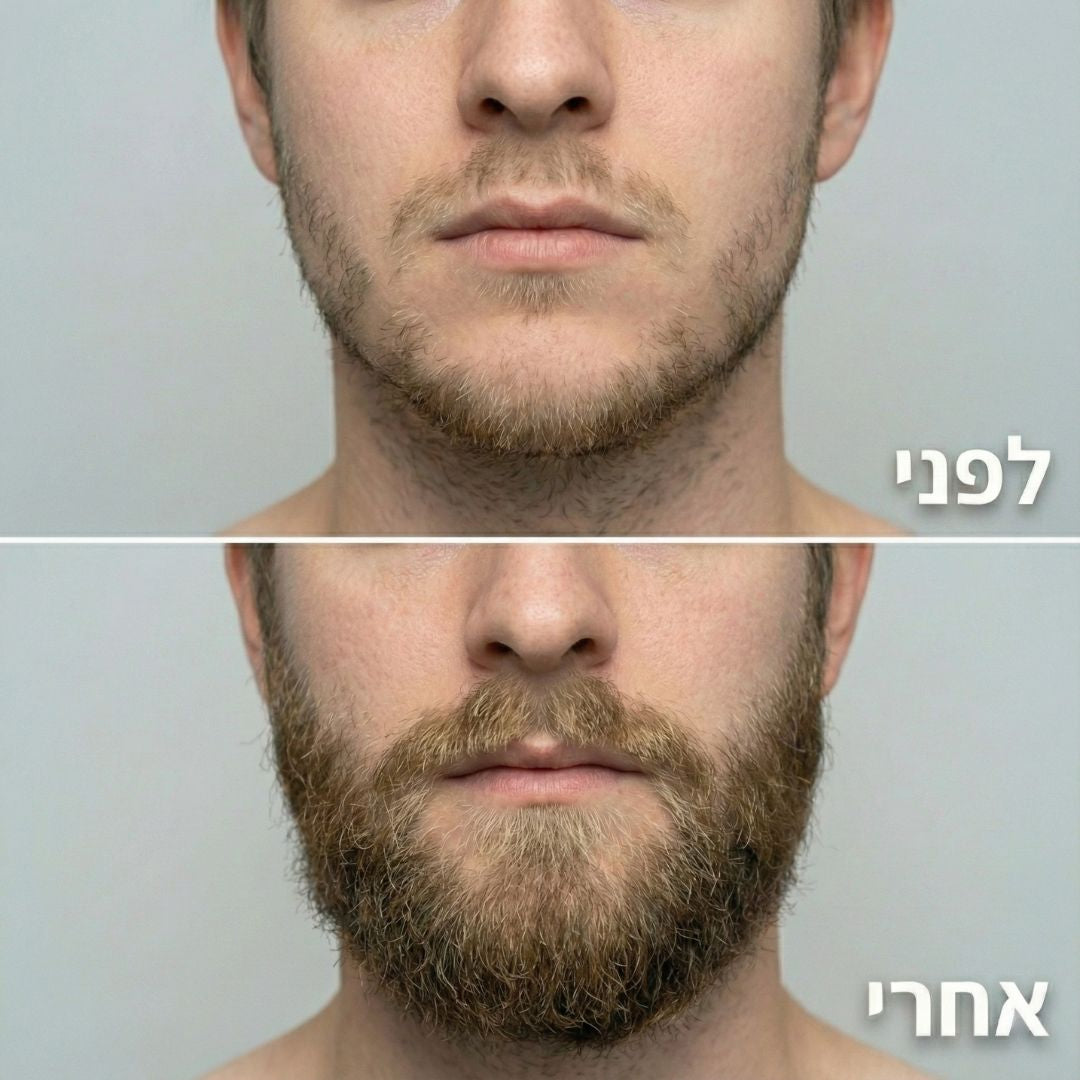 ReBeard ืจืืืจ + ืกืจืื ืืฆืืืืช ืืงื ืืื ืืืืจื