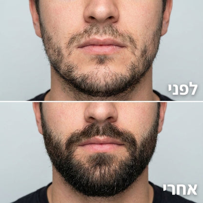 ReBeard רולר + סרום לצמיחת זקן מלא וגברי