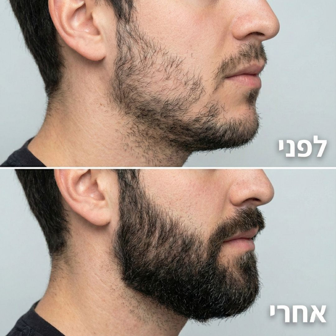 ReBeard רולר + סרום לצמיחת זקן מלא וגברי