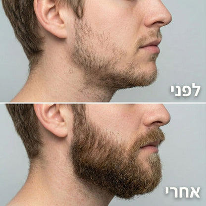 ReBeard רולר + סרום לצמיחת זקן מלא וגברי